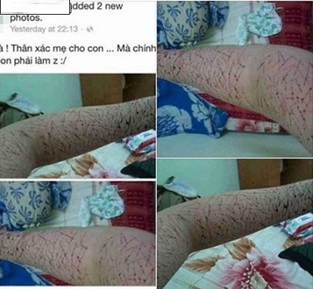 Rộ "trào lưu" nữ sinh rạch tay khoe tự tử trên Facebook